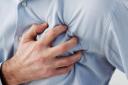 Little known symptoms of heart disease include leg pain and jaw pain